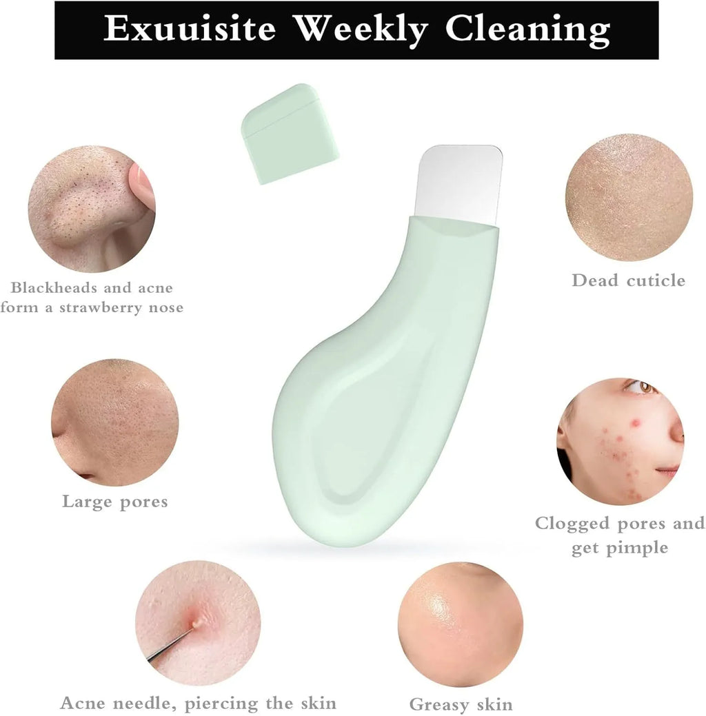 Green stainless steel pore scraper facial tool with a non-slip handle for blackhead removal.