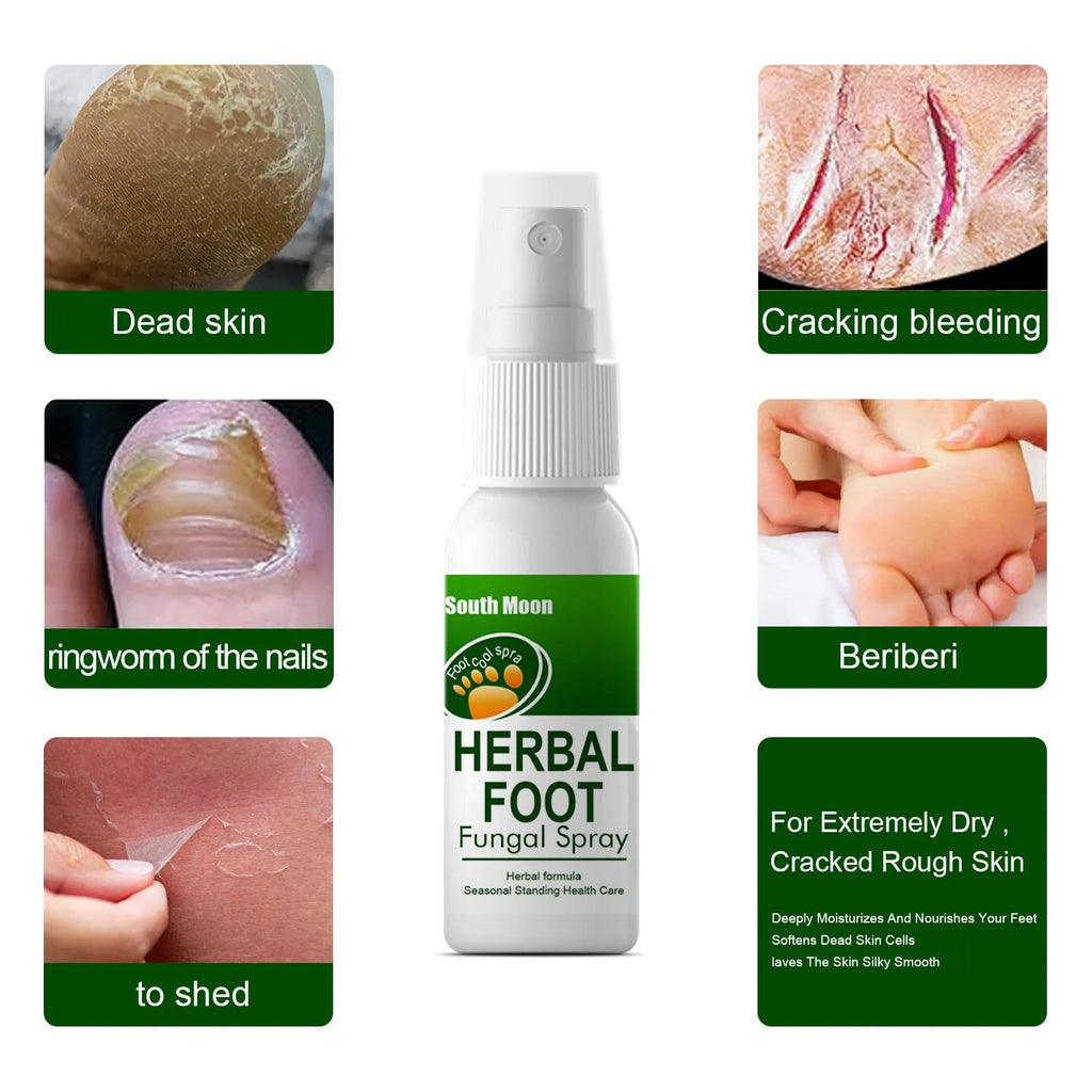30ml foot care spray bottle for nourishing and hydrating dry foot skin