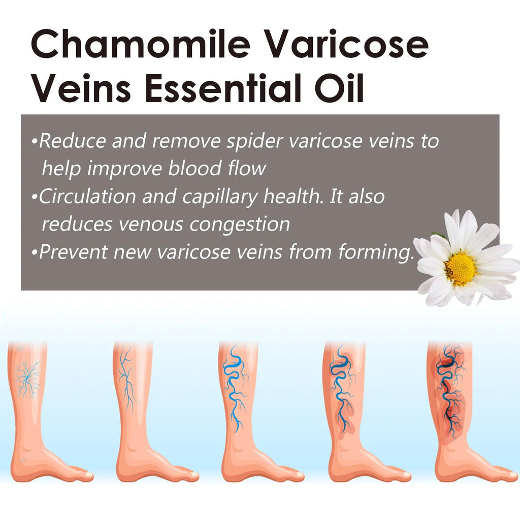 10ml glass bottle of pure chamomile essential oil for leg massage and skin care