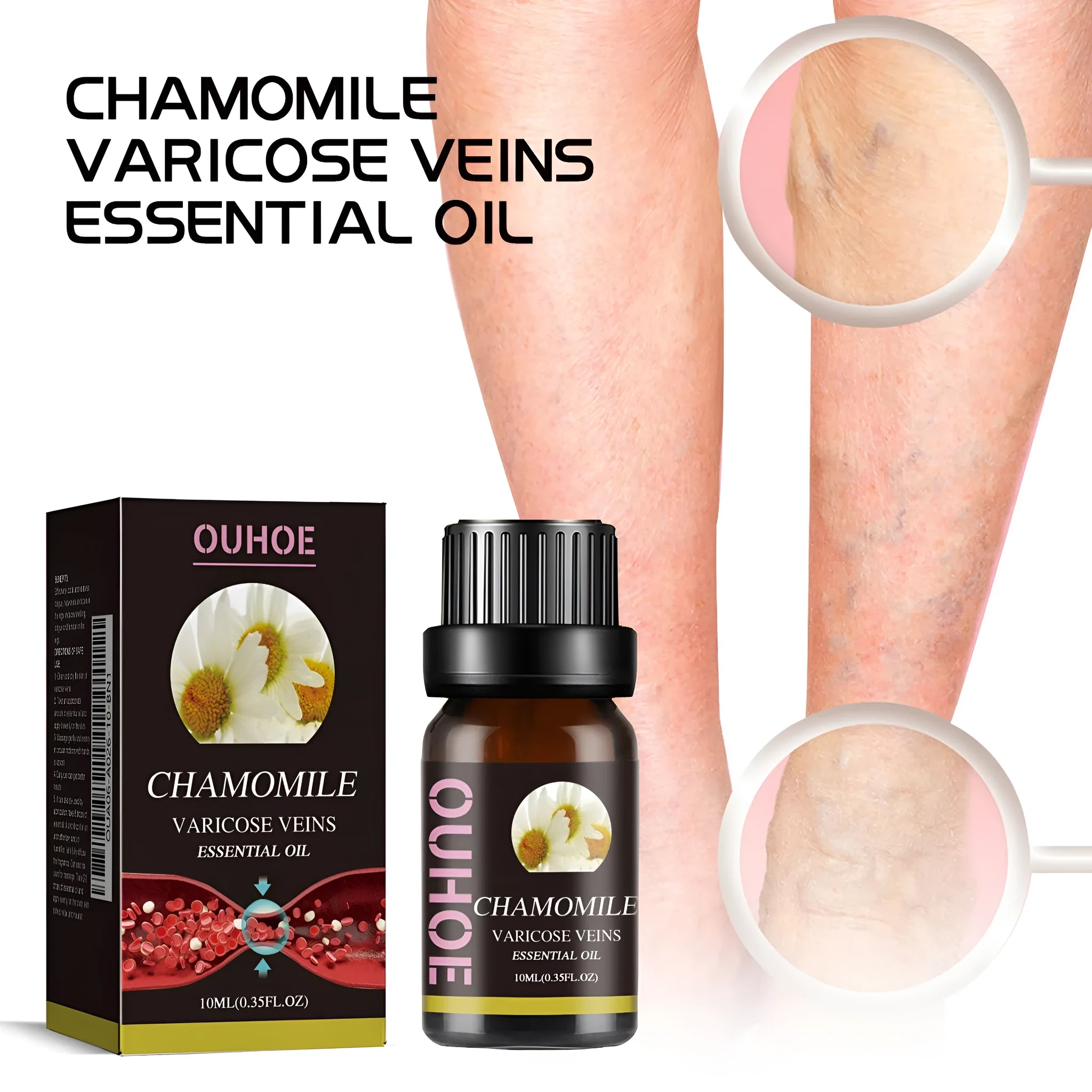 10ml glass bottle of pure chamomile essential oil for leg massage and skin care