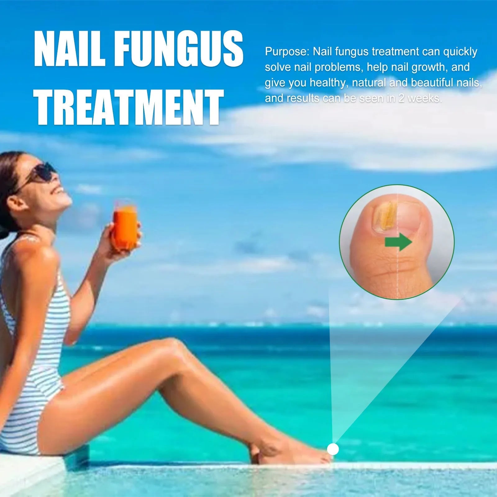 30ml tea tree oil nail care solution bottle for thickened fingernails and toenails