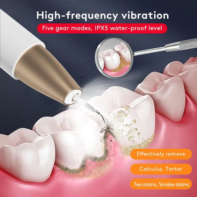 Gold coloured ultrasonic tooth cleaning device with metal scaler tip for tartar and stain removal.