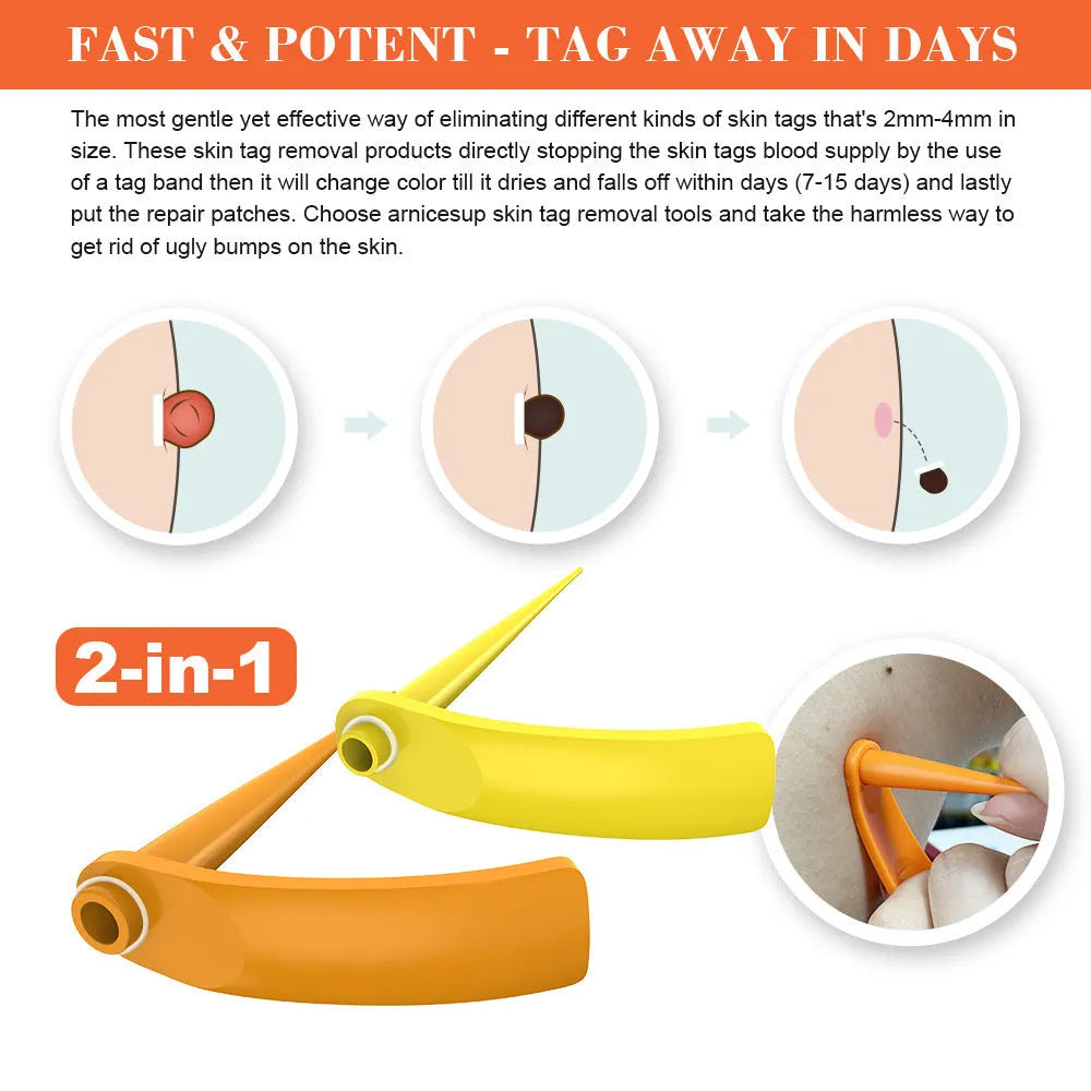 Orange handheld mole removal device with rubber rings, cones, alcohol swabs, and manual