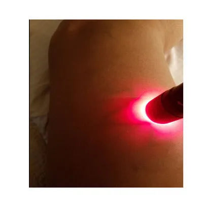 Black aluminium alloy Smart Vein Locator medical device with red LED light.