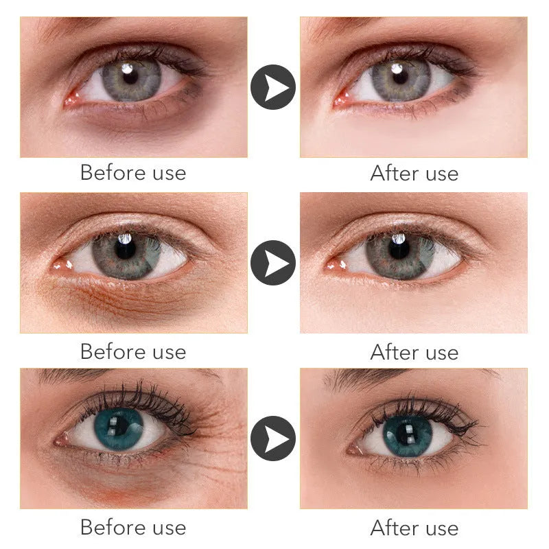 Beauty Eye Cream 30ml container for women's anti-aging eye treatment