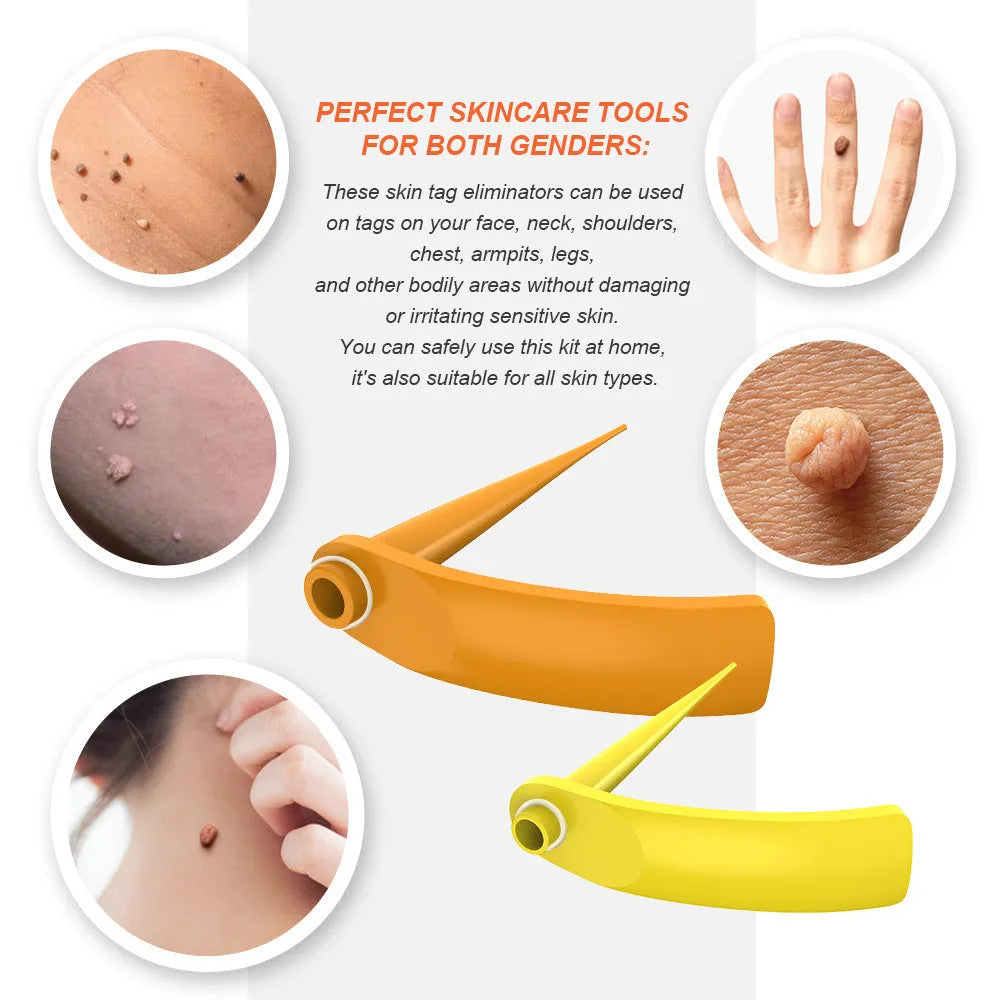 Orange handheld mole removal device with rubber rings, cones, alcohol swabs, and manual