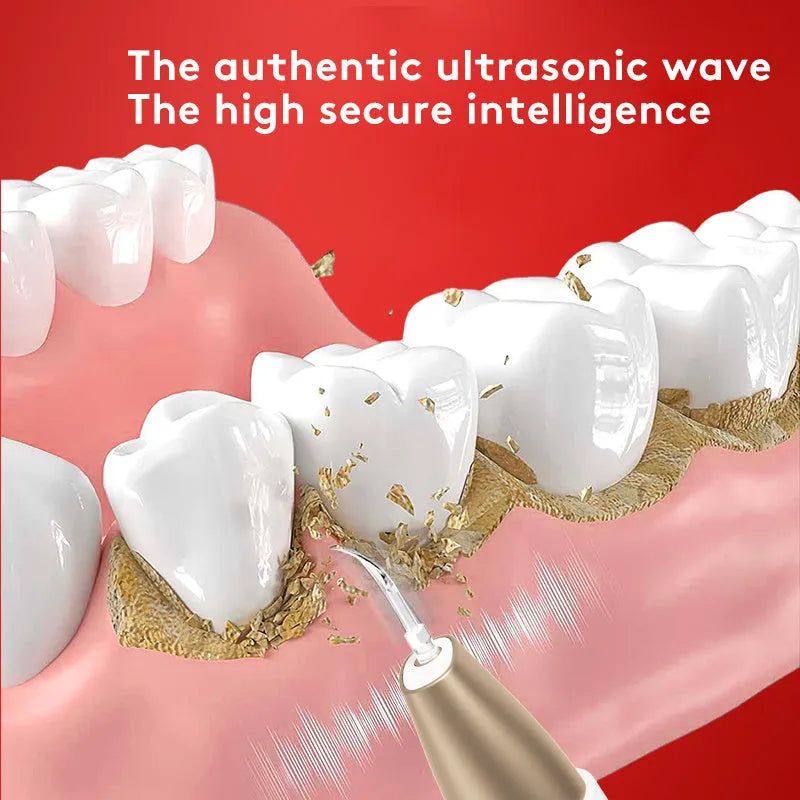 Gold coloured ultrasonic tooth cleaning device with metal scaler tip for tartar and stain removal.